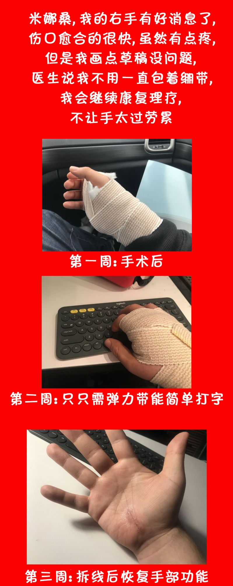 艾瑪 - 欽定？ - 1